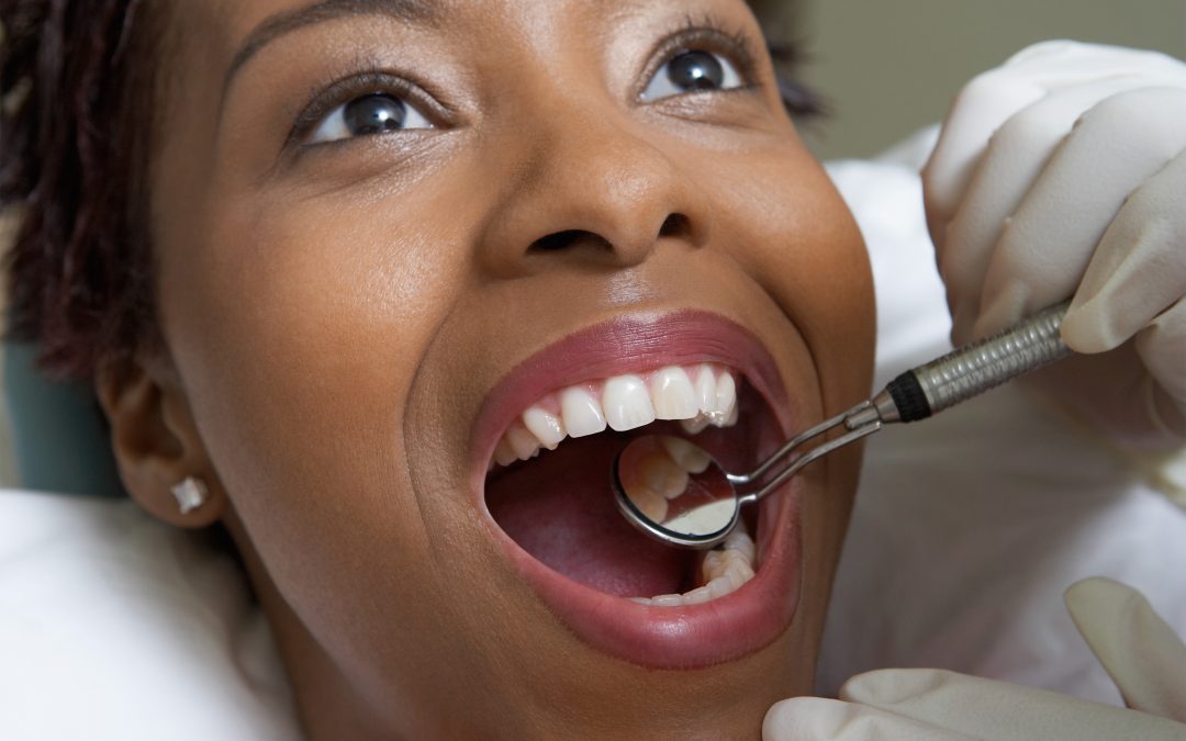 Dental Crowns: What You Should Know about this Royal Treatment