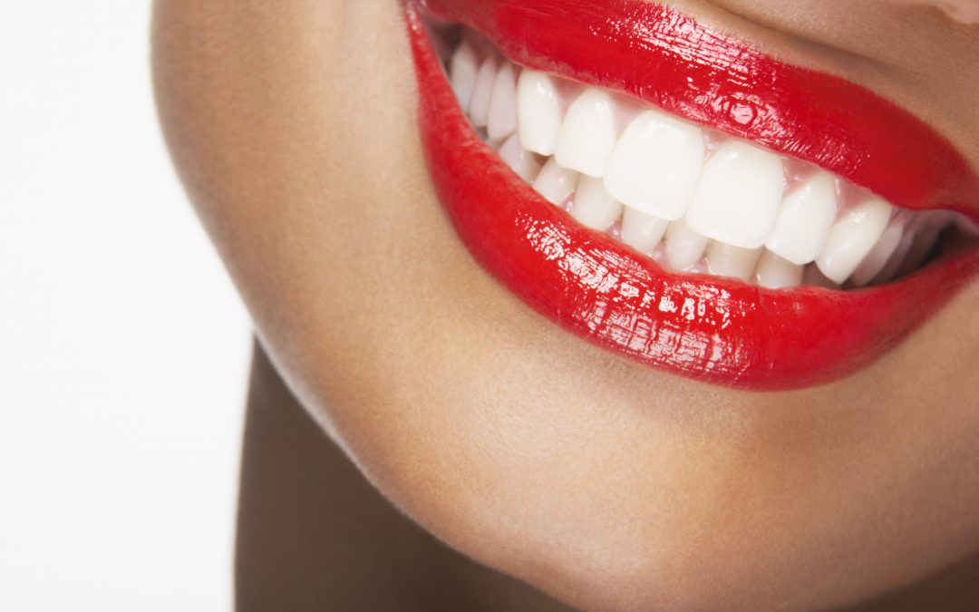 6 Steps to Keep Your Teeth White After a Teeth Whitening Treatment