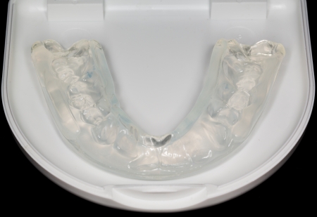 4 Signs You Need a Night Guard for Teeth Grinding