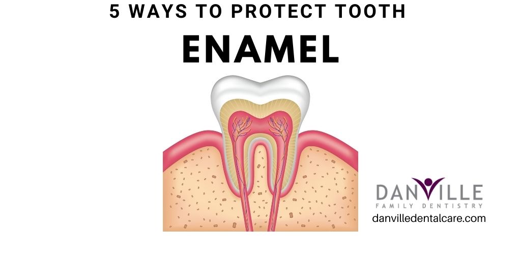 5 Best Ways to Prevent Tooth Enamel Erosion