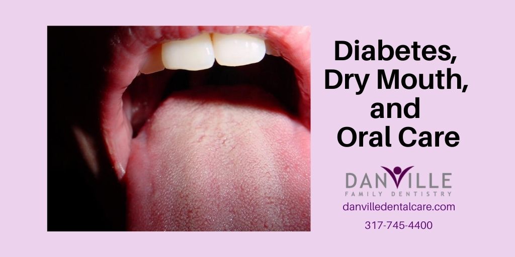 Diabetes, Dry Mouth and Oral Care