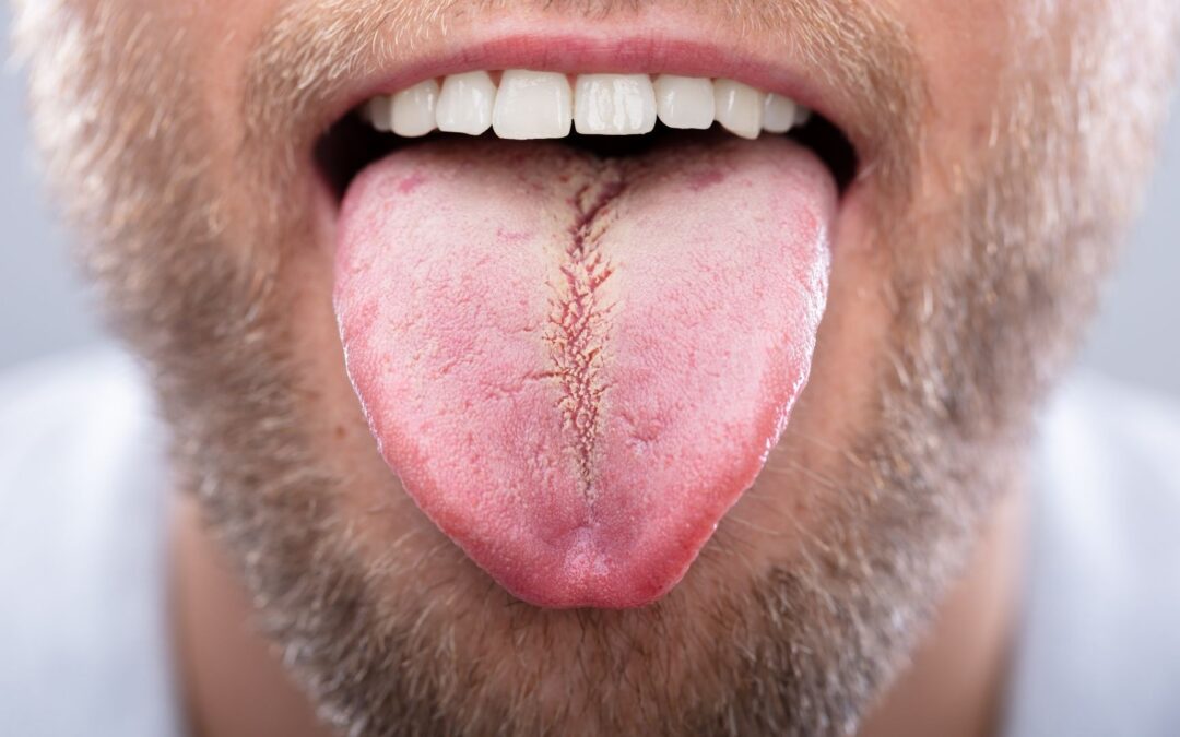 Oral exams include an examination of your tongue. Here are the reasons why.