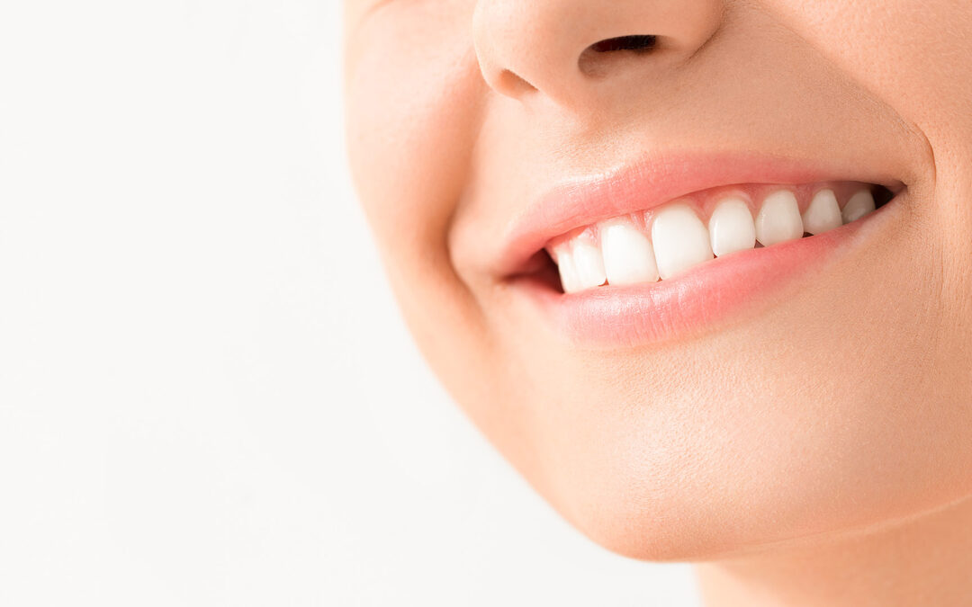 Is Your Smile Full of White Teeth?